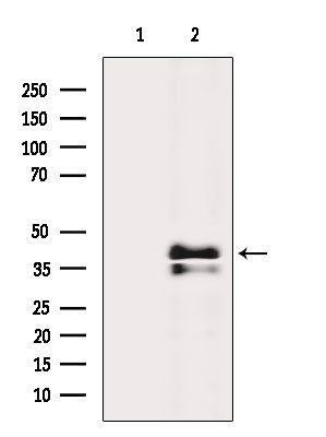 AGTR1 Antibody in Western Blot (WB)