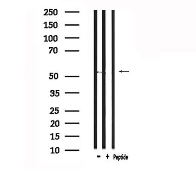 GPR37L1 Antibody in Western Blot (WB)