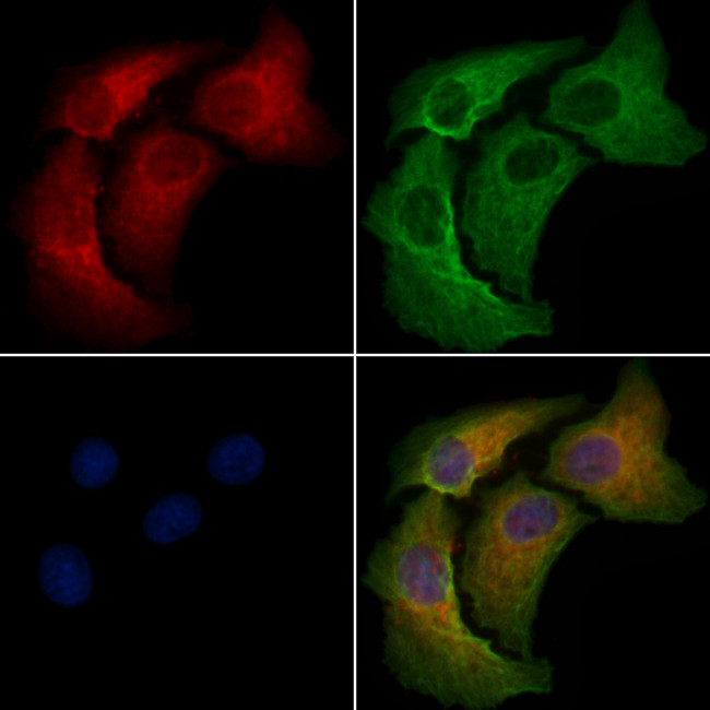 GPRC5B Antibody in Immunocytochemistry (ICC/IF)