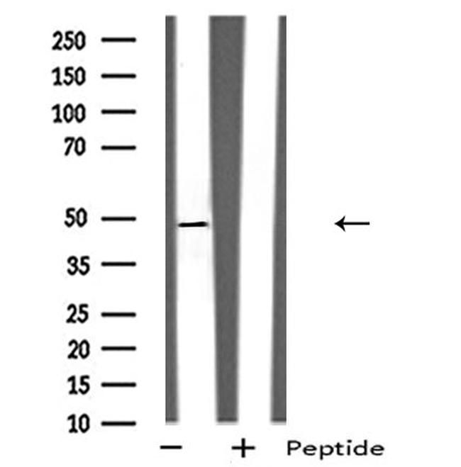 GPRC5B Antibody in Western Blot (WB)