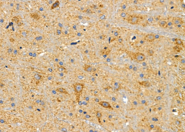 NPY1R Antibody in Immunohistochemistry (Paraffin) (IHC (P))