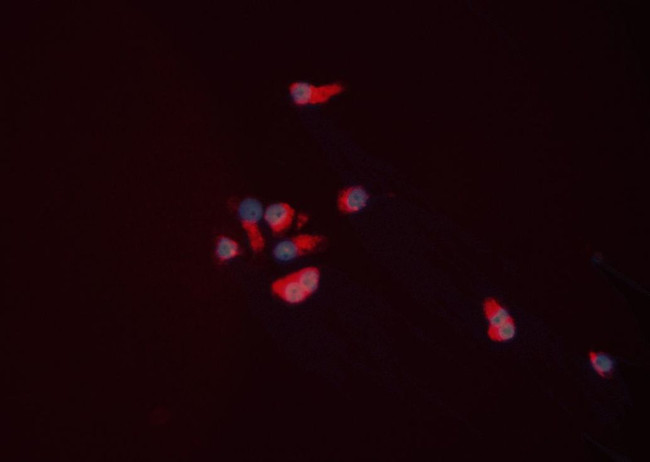 NPY5R Antibody in Immunocytochemistry (ICC/IF)