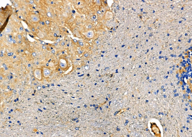 NPY5R Antibody in Immunohistochemistry (Paraffin) (IHC (P))