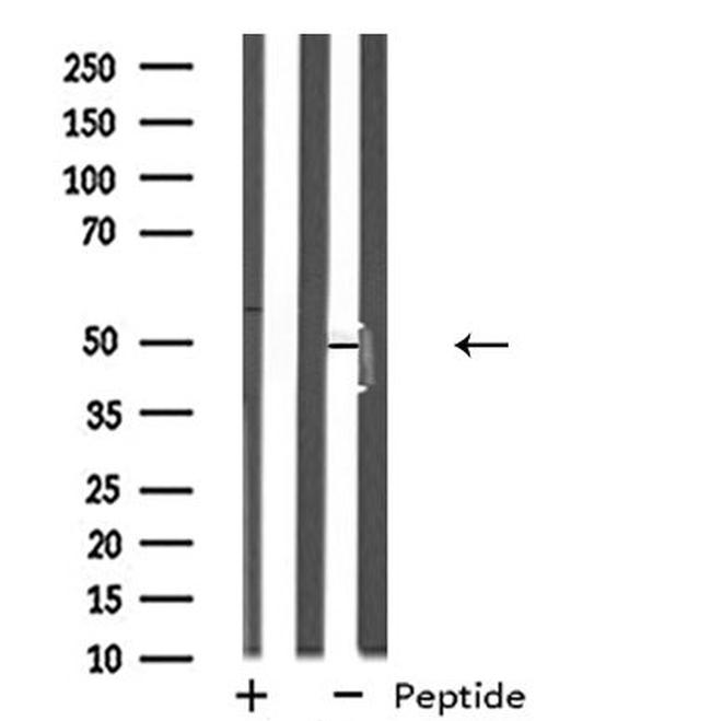 NPY5R Antibody in Western Blot (WB)