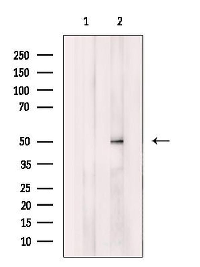 QRFPR Antibody in Western Blot (WB)