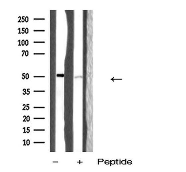 QRFPR Antibody in Western Blot (WB)