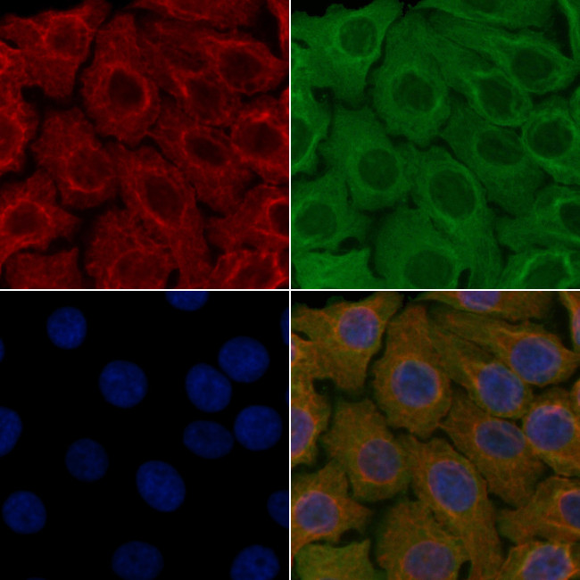 SCTR Antibody in Immunocytochemistry (ICC/IF)