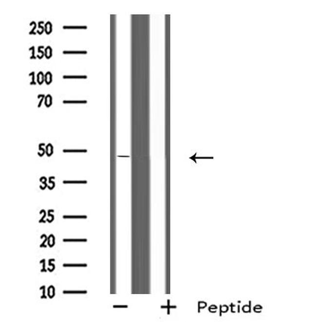 SCTR Antibody in Western Blot (WB)