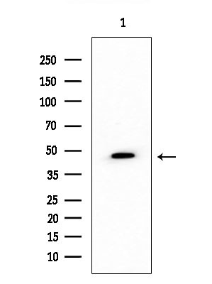SCTR Antibody in Western Blot (WB)