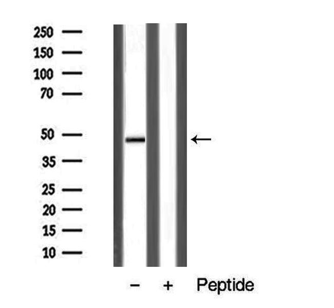 AVPR1B Antibody in Western Blot (WB)