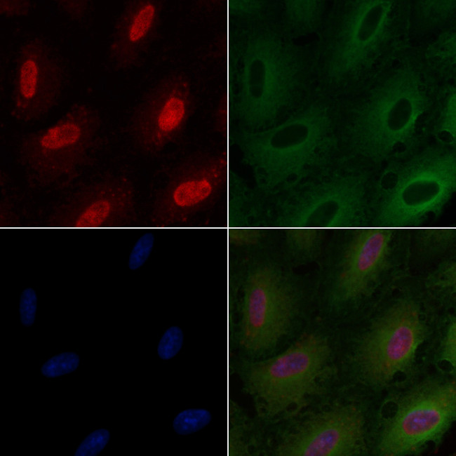 ARNT Antibody in Immunocytochemistry (ICC/IF)