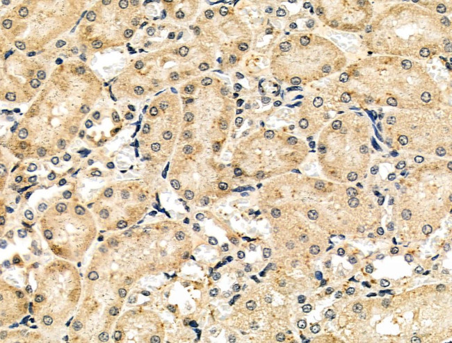 ARNT Antibody in Immunohistochemistry (Paraffin) (IHC (P))