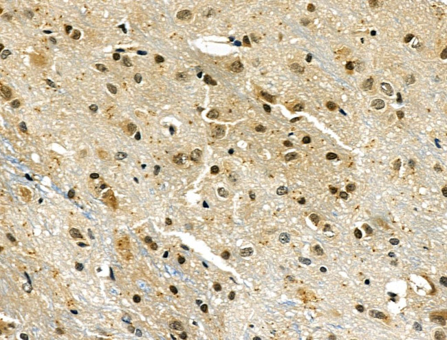 ARNT Antibody in Immunohistochemistry (Paraffin) (IHC (P))