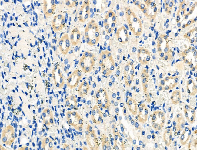 STAR Antibody in Immunohistochemistry (Paraffin) (IHC (P))