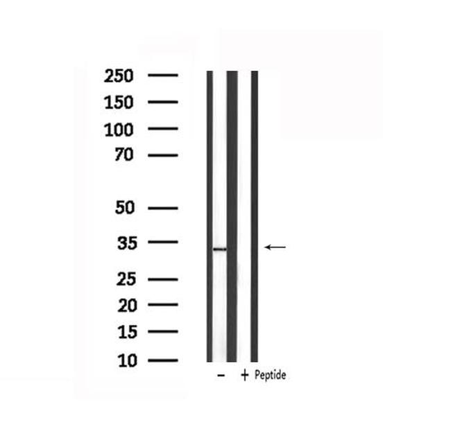 STAR Antibody in Western Blot (WB)