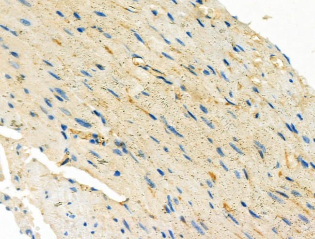 Endothelin 3 Antibody in Immunohistochemistry (Paraffin) (IHC (P))