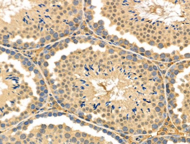 Endothelin 3 Antibody in Immunohistochemistry (Paraffin) (IHC (P))