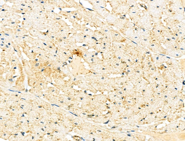 Endothelin 3 Antibody in Immunohistochemistry (Paraffin) (IHC (P))