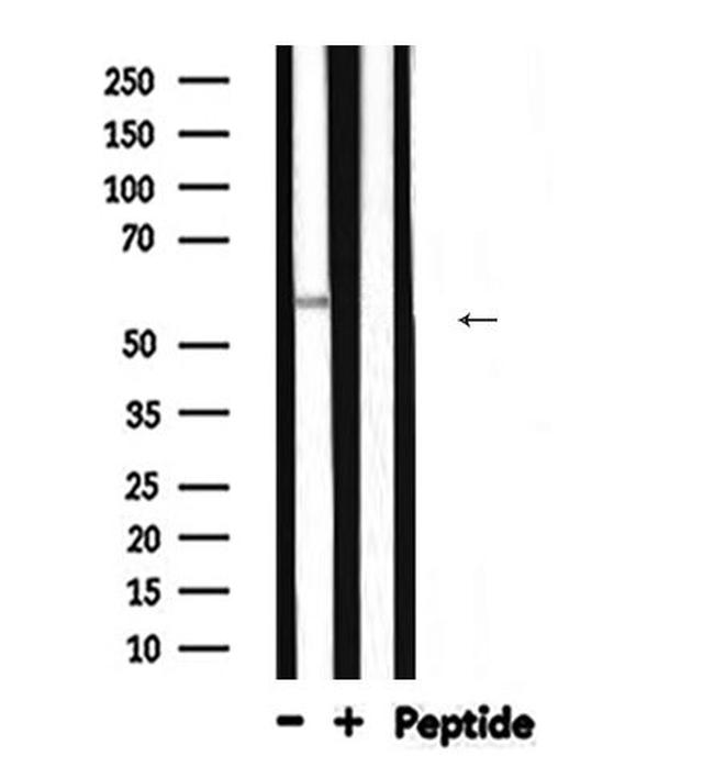 ALPL Antibody in Western Blot (WB)