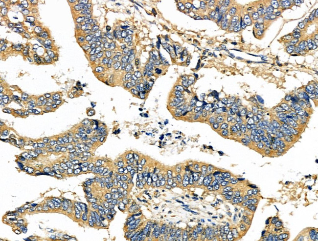 C19orf10 Antibody in Immunohistochemistry (Paraffin) (IHC (P))