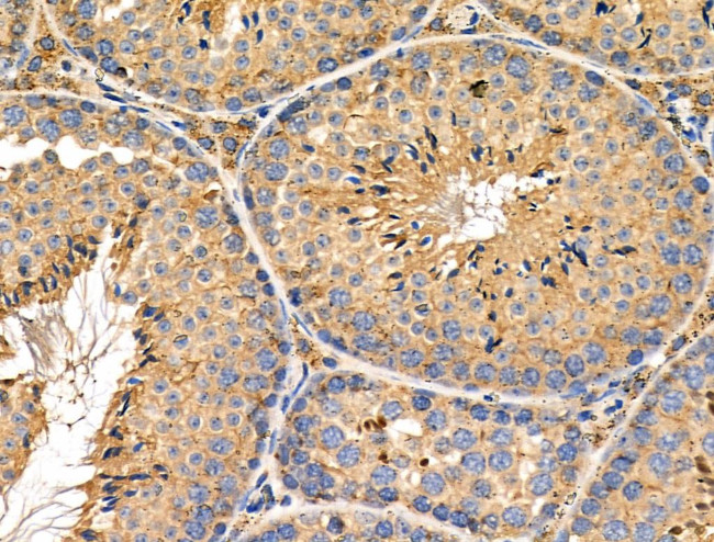 C19orf10 Antibody in Immunohistochemistry (Paraffin) (IHC (P))