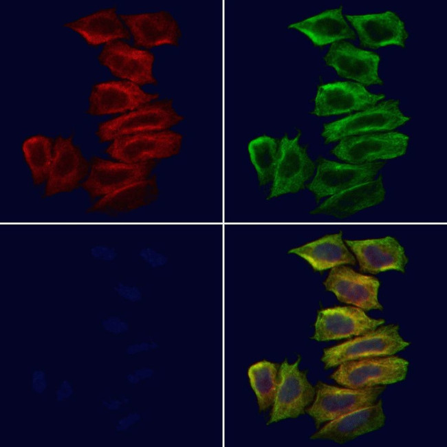 TRADD Antibody in Immunocytochemistry (ICC/IF)