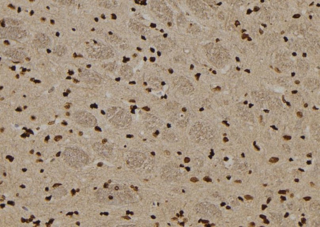 TRADD Antibody in Immunohistochemistry (Paraffin) (IHC (P))