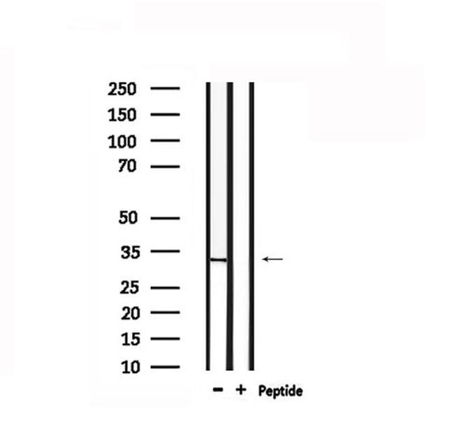 TRADD Antibody in Western Blot (WB)