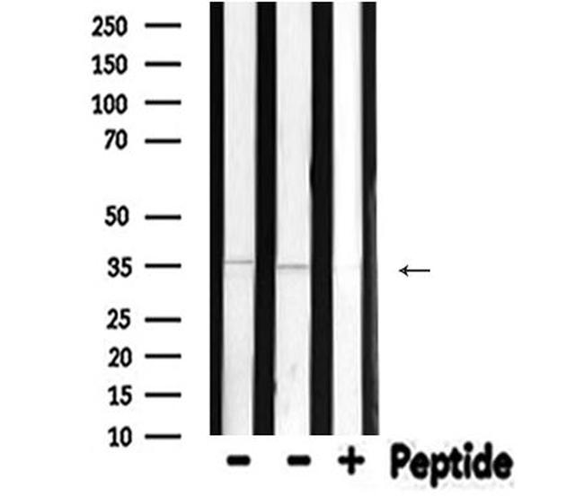 NeuroD1 Antibody in Western Blot (WB)