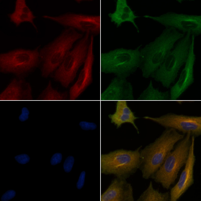 KCNE1 Antibody in Immunocytochemistry (ICC/IF)