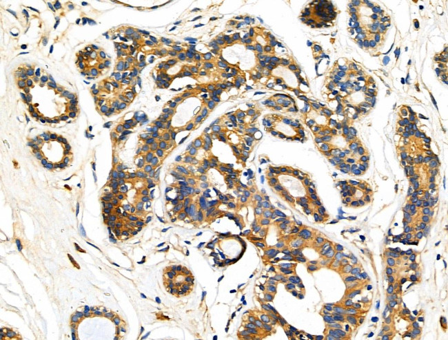 KCNE1 Antibody in Immunohistochemistry (Paraffin) (IHC (P))