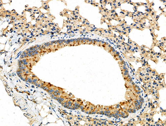 KCNE1 Antibody in Immunohistochemistry (Paraffin) (IHC (P))