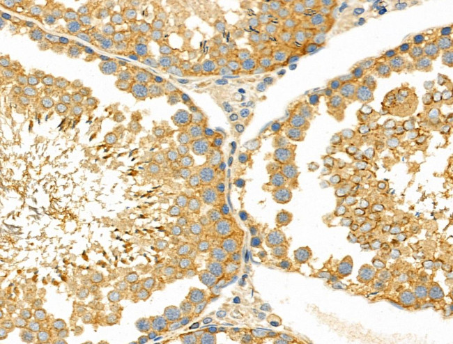 KCNE1 Antibody in Immunohistochemistry (Paraffin) (IHC (P))