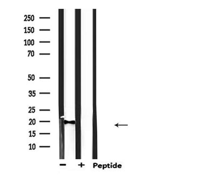 KCNE1 Antibody in Western Blot (WB)