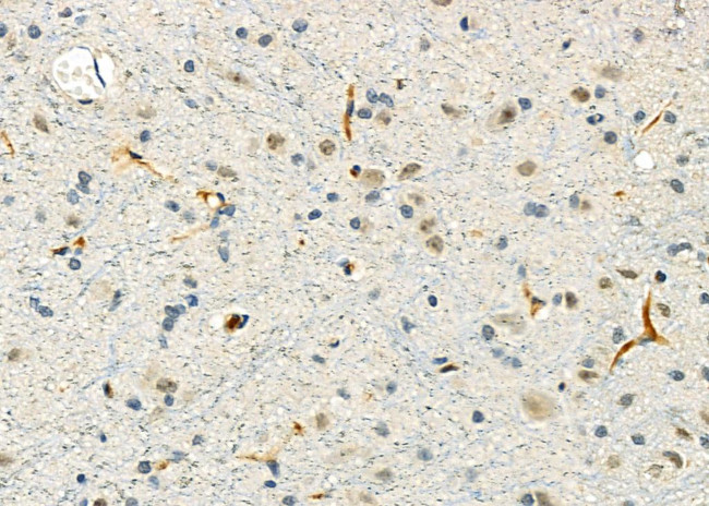 CGA Antibody in Immunohistochemistry (Paraffin) (IHC (P))