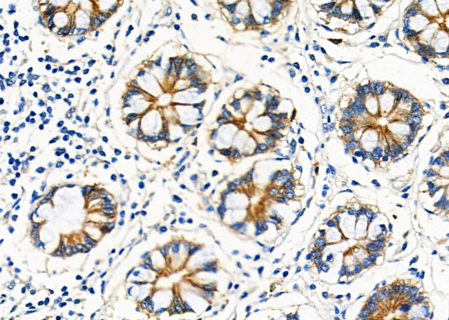 CGA Antibody in Immunohistochemistry (Paraffin) (IHC (P))