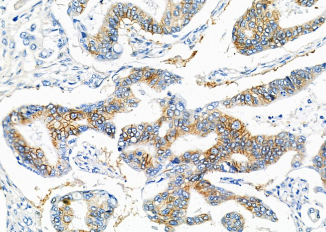 CGA Antibody in Immunohistochemistry (Paraffin) (IHC (P))