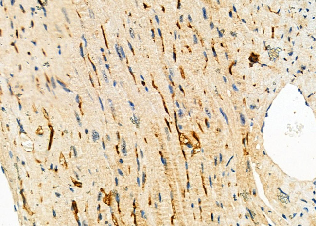 CGA Antibody in Immunohistochemistry (Paraffin) (IHC (P))