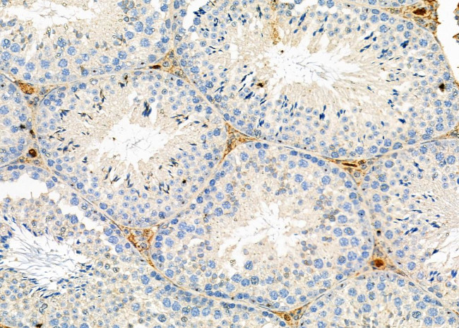 CGA Antibody in Immunohistochemistry (Paraffin) (IHC (P))