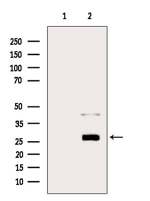 Trypsin Antibody in Western Blot (WB)