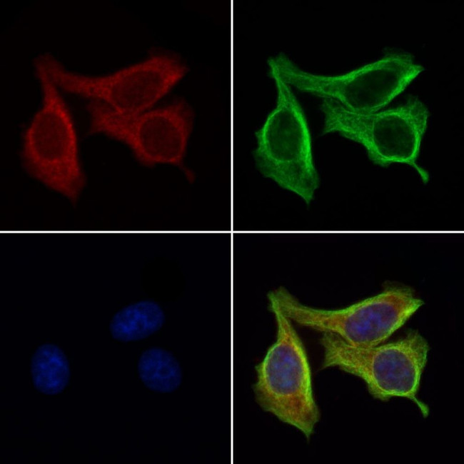 Trypsin Antibody in Immunocytochemistry (ICC/IF)