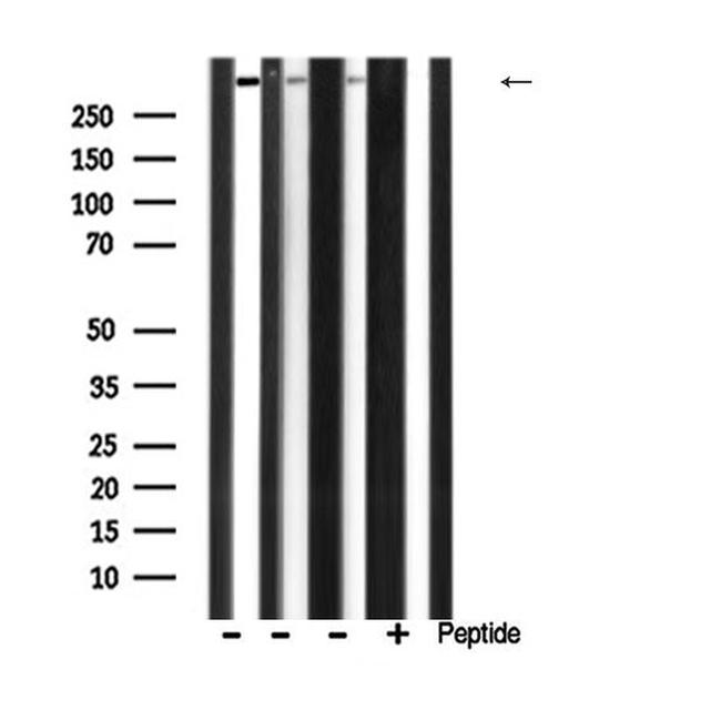 Factor VIII Antibody in Western Blot (WB)