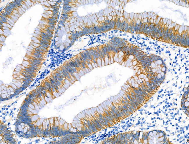 ABO Antibody in Immunohistochemistry (Paraffin) (IHC (P))