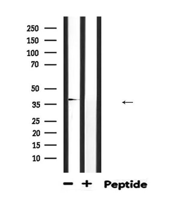 ABO Antibody in Western Blot (WB)