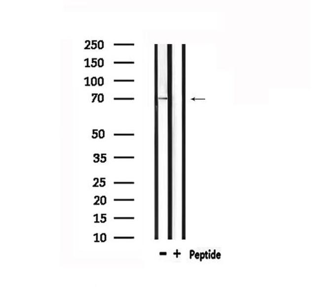 Protein S Antibody in Western Blot (WB)
