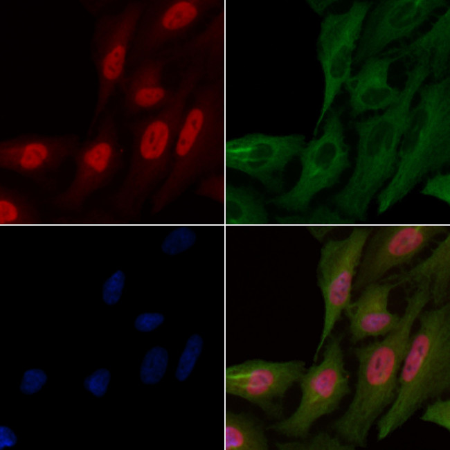 BTRC Antibody in Immunocytochemistry (ICC/IF)