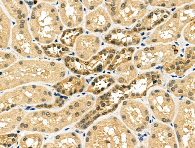 BTRC Antibody in Immunohistochemistry (Paraffin) (IHC (P))