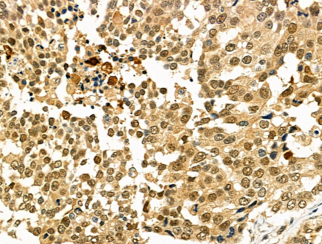 BTRC Antibody in Immunohistochemistry (Paraffin) (IHC (P))