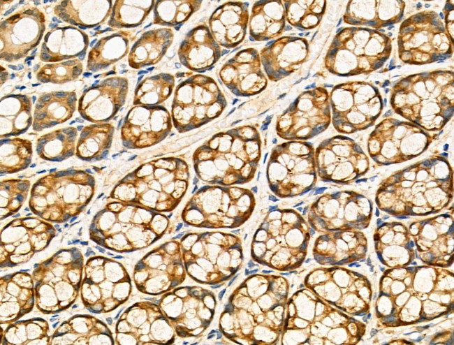 BTRC Antibody in Immunohistochemistry (Paraffin) (IHC (P))