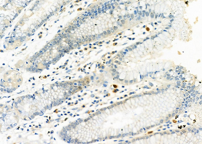 Complement Factor B Antibody in Immunohistochemistry (Paraffin) (IHC (P))